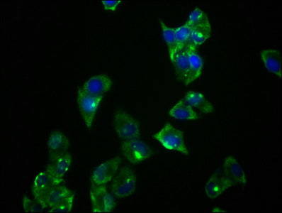 PRKAR1A Antibody