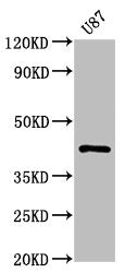 PRKAR1A Recombinant Monoclonal Antibody