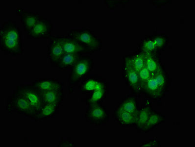 Phospho-PRKCA (T638) Antibody