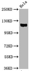 Phospho-PTK2 (Y397) Antibody