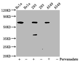 Phospho-PTPN11 (Y542) Recombinant Monoclonal Antibody