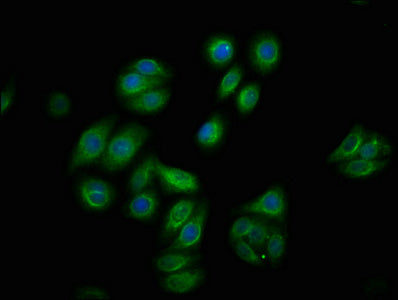 Phospho-RAF1 (S259) Antibody