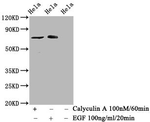 Phospho-RAF1 (S621) Antibody