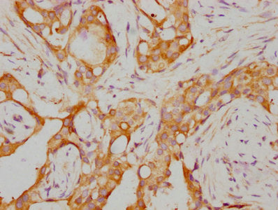 RARA Recombinant Monoclonal Antibody