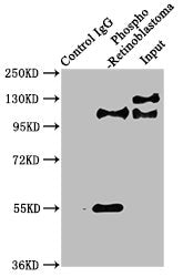 Phospho-RB1 (S780) Antibody