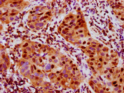 Phospho-RPS6KA5 (S376) Recombinant Monoclonal Antibody