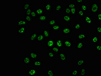 Phospho-RPS6KB1 (T421+S424) Antibody