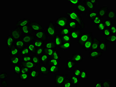 Phospho-SNCA (S129) Antibody