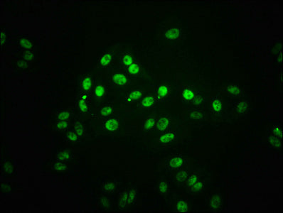 Phospho-STAT1 (S727) Antibody