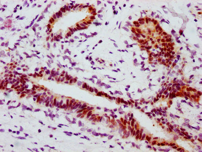 Phospho-STAT1 (S727) Antibody