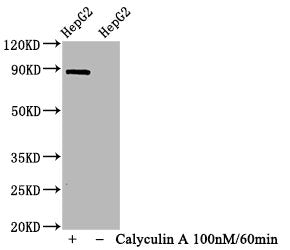 Phospho-STAT1 (S727) Antibody