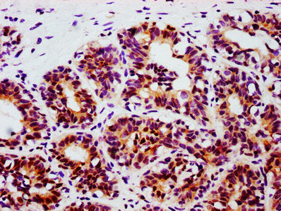 Phospho-STAT3 (Tyr705) Antibody