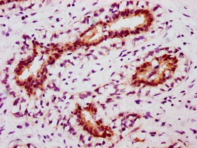 Phospho-STAT5A (Y694) Antibody