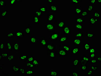 Phospho-TP53 (S33) Antibody