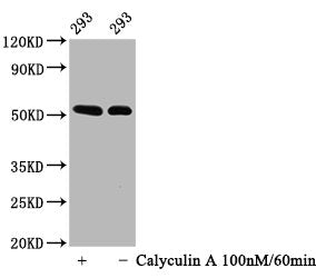 Phospho-TP53 (S392) Recombinant Monoclonal Antibody