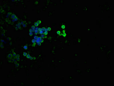 Phospho-TP53 (T55) Antibody