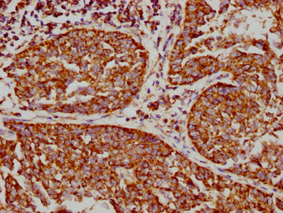 VDAC1 Antibody