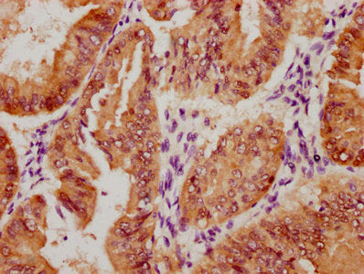 Phospho-YAP1 (S127) Antibody
