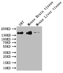 SF3B1 Recombinant Monoclonal Antibody