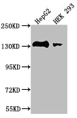 MYLK Recombinant Monoclonal Antibody