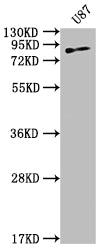 TGM2 Recombinant Monoclonal Antibody