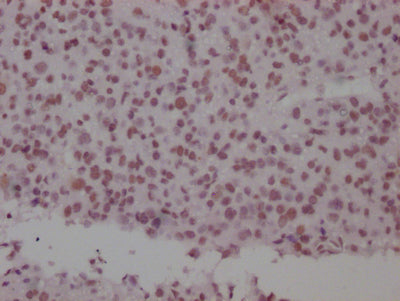 SMC1A Antibody
