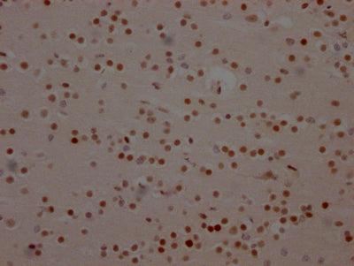 BRD4 Antibody
