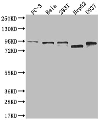 DBF4 Recombinant Monoclonal Antibody