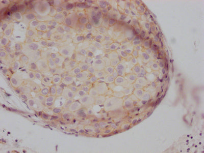 CTNNB1 Recombinant Monoclonal Antibody