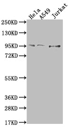 CARS Recombinant Monoclonal Antibody