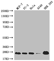 MRAS Recombinant Monoclonal Antibody