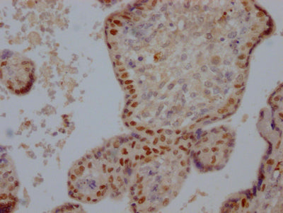 DNMT1 Recombinant Monoclonal Antibody