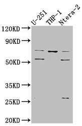 PTH1R Recombinant Monoclonal Antibody