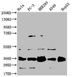 HMGCL Recombinant Monoclonal Antibody