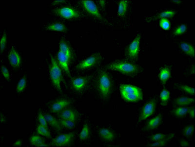 RHEB Recombinant Monoclonal Antibody