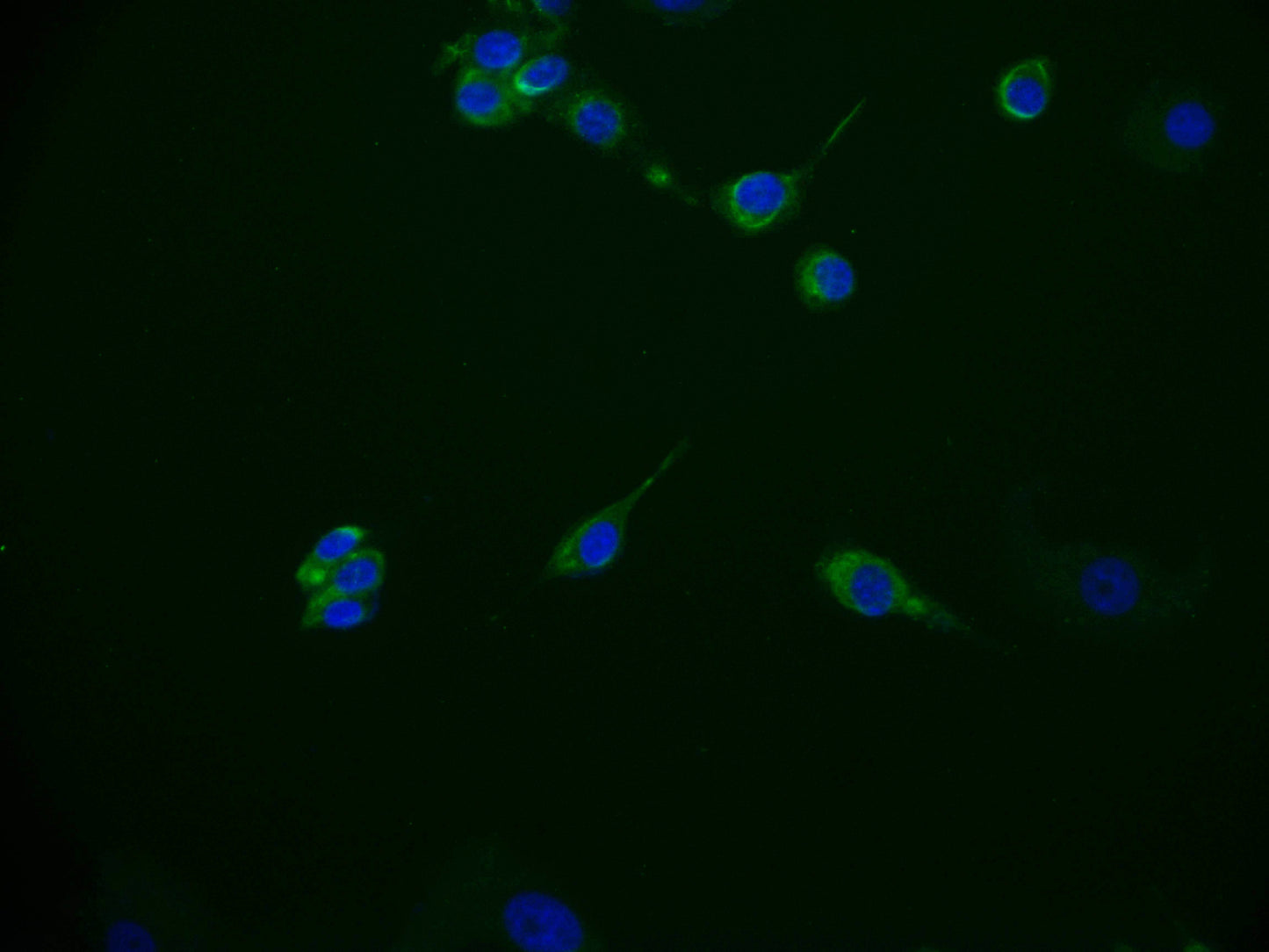 ITGA6 Recombinant Monoclonal Antibody