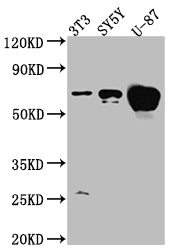 ESR1 Recombinant Monoclonal Antibody