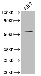 UAP1 Recombinant Monoclonal Antibody