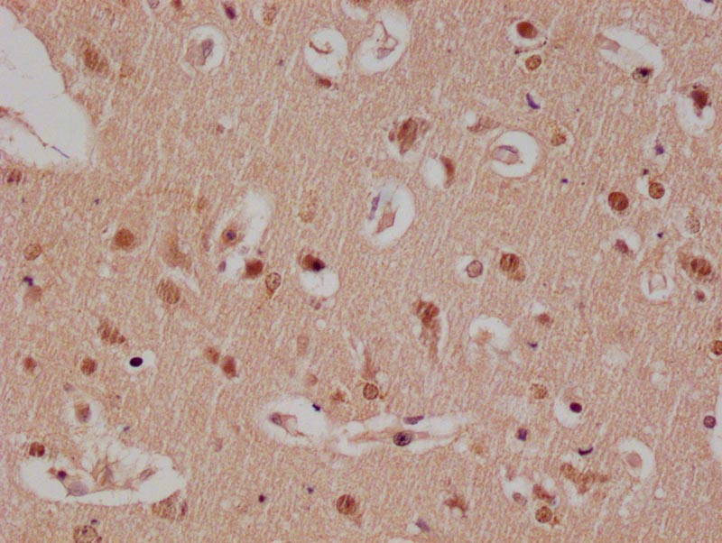 E2F4 Recombinant Monoclonal Antibody