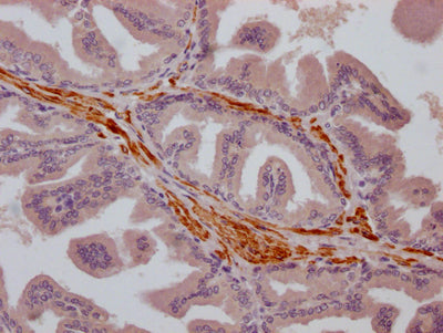 TRPM8 Recombinant Monoclonal Antibody