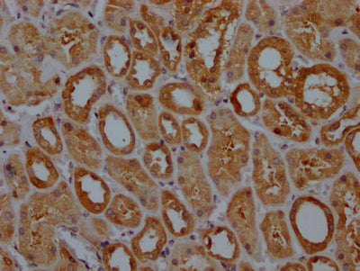 GPX4 Recombinant Monoclonal Antibody
