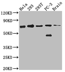LTA4H Recombinant Monoclonal Antibody