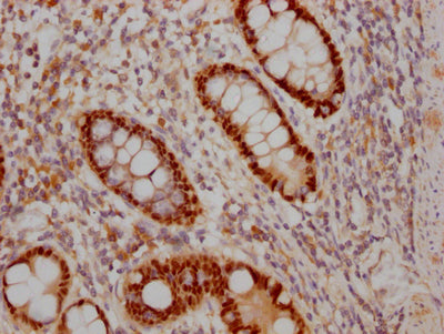 SOX9 Recombinant Monoclonal Antibody