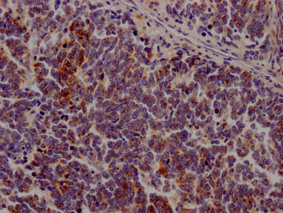 JAK3 Recombinant Monoclonal Antibody