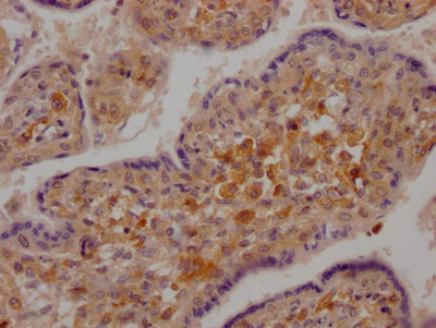 DDX58 Recombinant Monoclonal Antibody