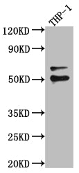 FLI1 Recombinant Monoclonal Antibody