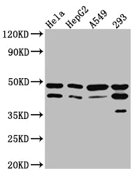 GSK3B Recombinant Monoclonal Antibody