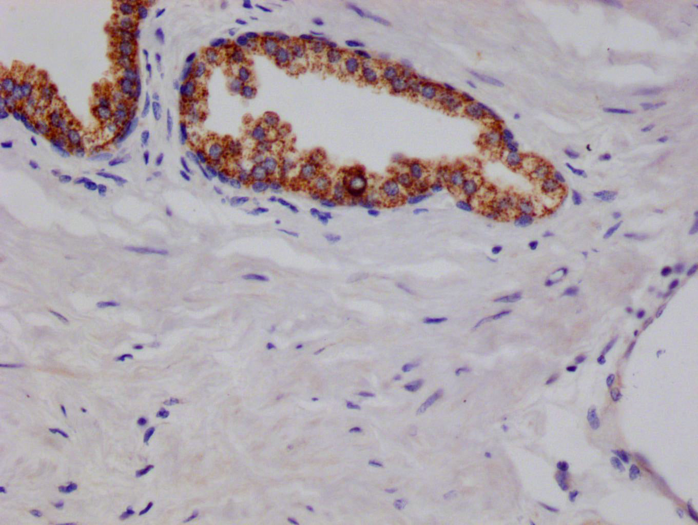 ARG2 Recombinant Monoclonal Antibody