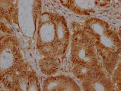 EZH2 Recombinant Monoclonal Antibody