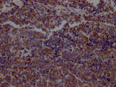 ACO2 Recombinant Monoclonal Antibody